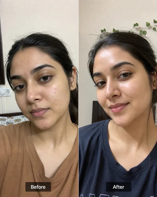 Customer result 3